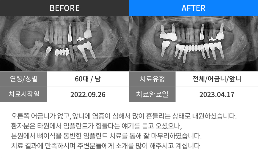 진료일지