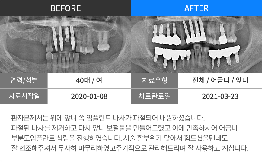 진료일지